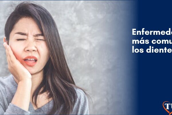 Enfermedades más comunes en los dientes